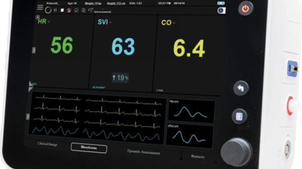 Image of Starling Fluid Management Monitoring System