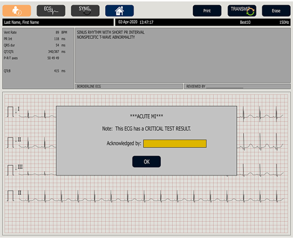 Close up shot of medical device screen