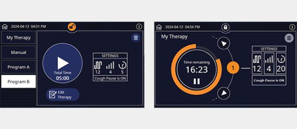 The Vest APX System locking screens are shown